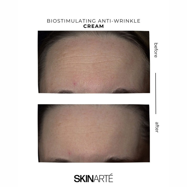 skinarte_ageless_biostymulujacy_krem_przeciwzmarszkowy_skinarte_ageless-4.jpg